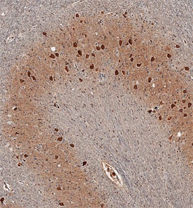 17 beta-HSD14/HSD17B14 antibody in Human Brain by Immunohistochemistry (IHC-P).