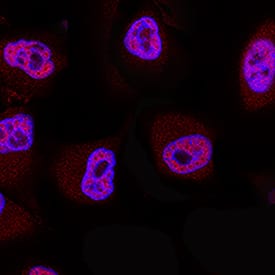 20S Proteasome antibody in A549 Human Cell Line by Immunocytochemistry (ICC).