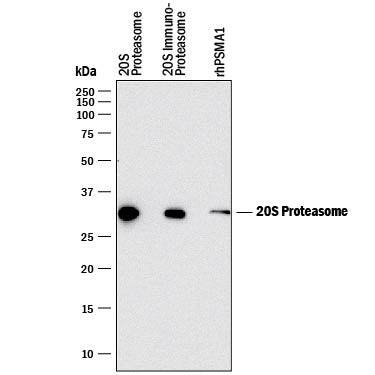 Detection of Human 20S Proteasome antibody by Western Blot.