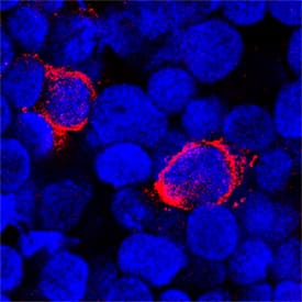 4-1BB/TNFRSF9/CD137 antibody in Human PBMCs by Immunocytochemistry (ICC).