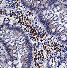 4-1BB Ligand/TNFSF9 antibody in Human Crohn's Disease Intestine by Immunohistochemistry (IHC-P).