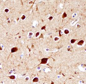 5HT2C antibody in Human Brain by Immunohistochemistry (IHC-P).