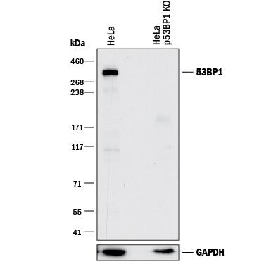 Western Blot Shows Human 53BP1 Antibody Specificity by Using Knockout Cell Line.