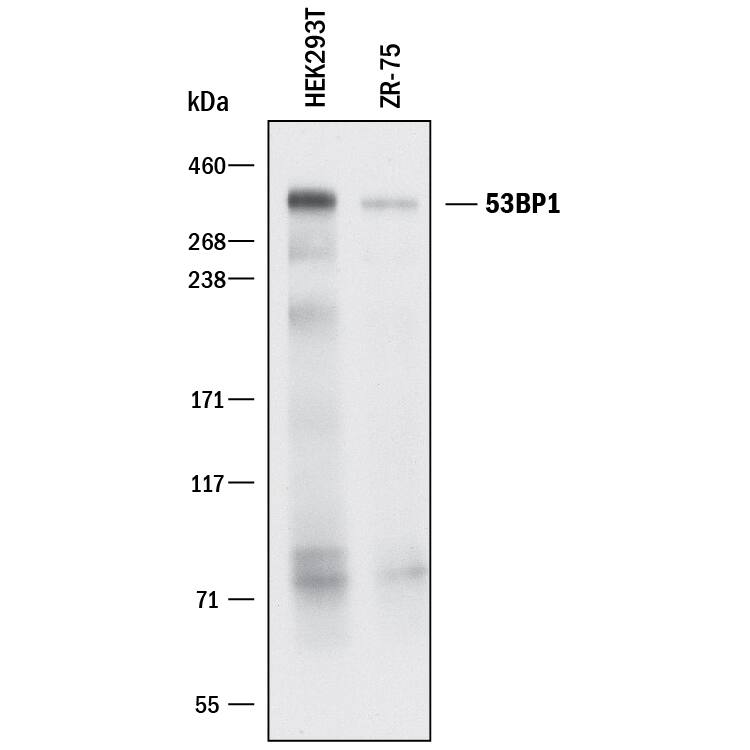 Detection of Human 53BP1 antibody by Western Blot.