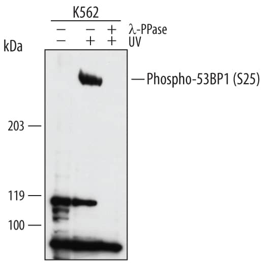 Detection of Human Phospho-53BP1 (S25) antibody by Western Blot.