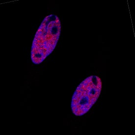 53BP1 antibody in HeLa Human Cell Line by Immunocytochemistry (ICC).