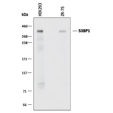 Detection of Human 53BP1 antibody by Western Blot.