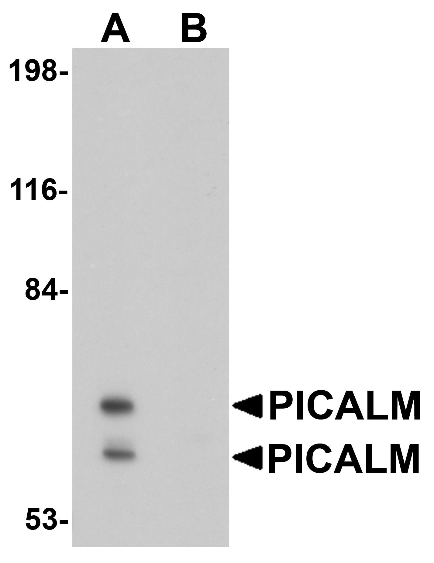 Western Blot: PICALM Antibody - BSA Free [NBP1-76254]