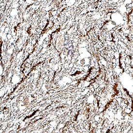 5-HT1D antibody in Human Brain by Immunohistochemistry (IHC-P).