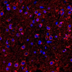 5-HT6 antibody in Rat Brain by Immunohistochemistry (IHC-Fr).