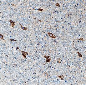 5-HT7 antibody in Human Brain (Hypothalamus) by Immunohistochemistry (IHC-P).