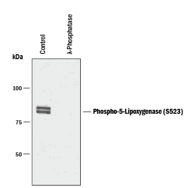 Detection of Phospho-5-Lipoxygenase (S523) antibody by Western Blot.