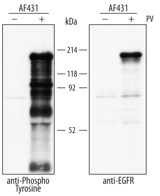 Immunoprecipitation of Human Phospho-tyrosine.