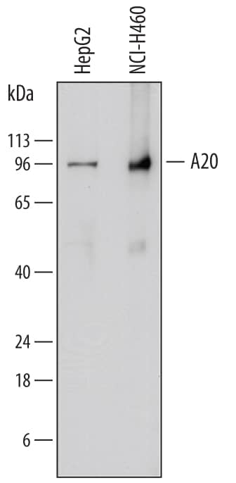 Detection of Human A20/TNFAIP3 antibody by Western Blot.