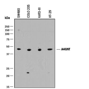 Detection of Human a-1,4-N-Acetylglucosaminyltransferase 4/A4GNT antibody by Western Blot.