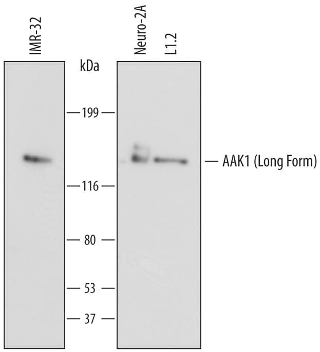 Detection of Human and Mouse AAK1 antibody by Western Blot.