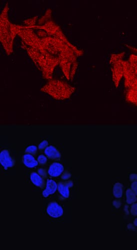 ABCA1 antibody in HepG2 Human Cell Line by Immunocytochemistry (ICC).