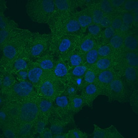 ABCG2 antibody in JAR Human Cell Line by Immunocytochemistry (ICC).