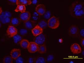 ABCG2 antibody in Human ABCG2 transfected CHO Chinese Hamster Cell Line by Immunocytochemistry (ICC).
