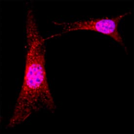 ABI1 antibody in A549 Human Cell Line by Immunocytochemistry (ICC).