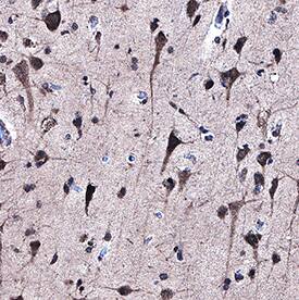 ABI1 antibody in Human Brain Tissue by Immunohistochemistry (IHC-P).
