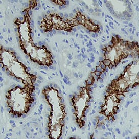 ACE-2 antibody in Human Kidney by Immunohistochemistry (IHC-P).