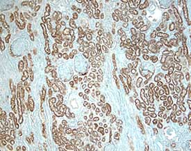 ACE/CD143 antibody in Human Kidney by Immunohistochemistry (IHC-P).