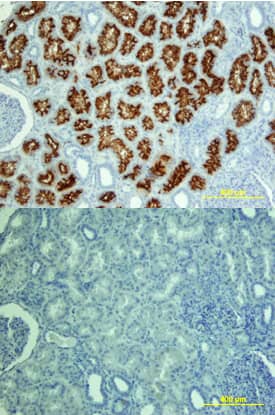 ACE/CD143 antibody in Human Kidney by Immunohistochemistry (IHC-P).