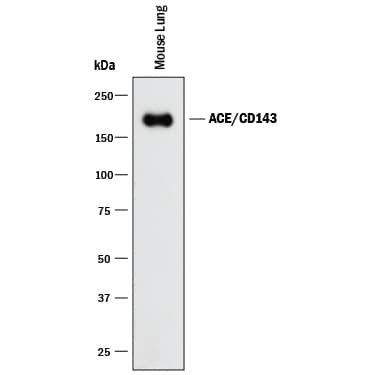 Detection of Mouse ACE/CD143 antibody by Western Blot.