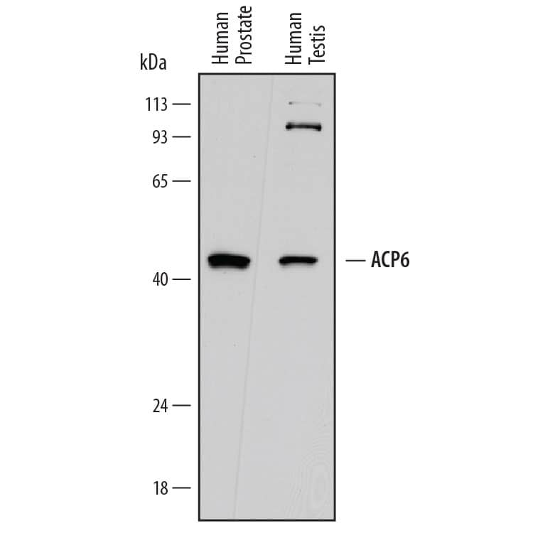 Detection of Human ACP6 antibody by Western Blot.