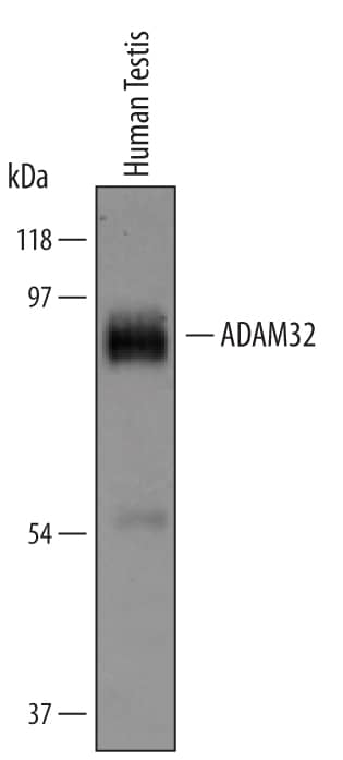 Detection of Human ADAM32 antibody by Western Blot.