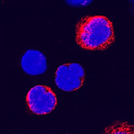 ADAM8 antibody in Human PBMCs by Immunocytochemistry (ICC).