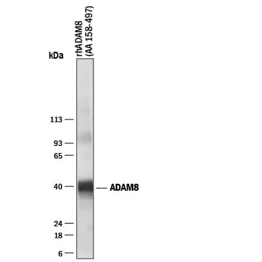 Detection of Human ADAM8 antibody by Western Blot.