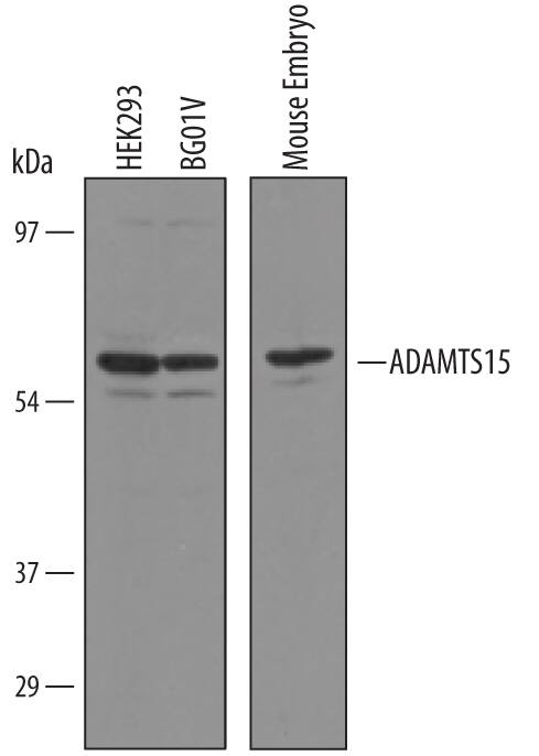 Detection of Human and Mouse ADAMTS15 antibody by Western Blot.