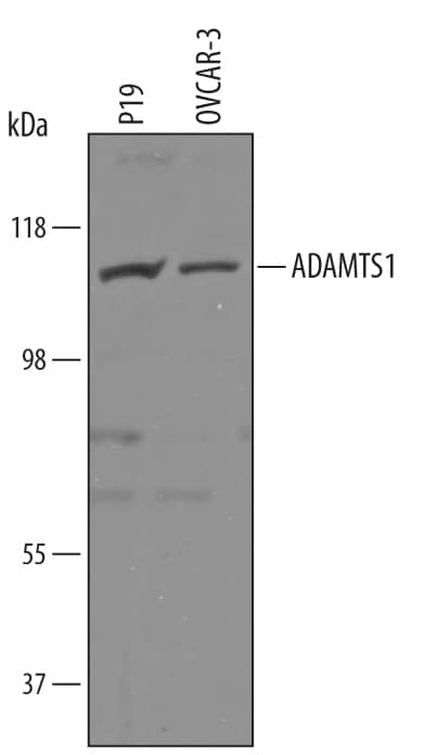 Detection of Human and Mouse ADAMTS1 antibody by Western Blot.