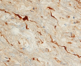 ADNP antibody in Human Brain by Immunohistochemistry (IHC-P).