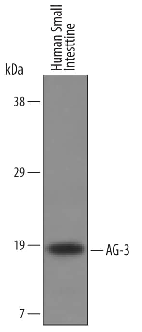 Detection of Human AG-3 antibody by Western Blot.