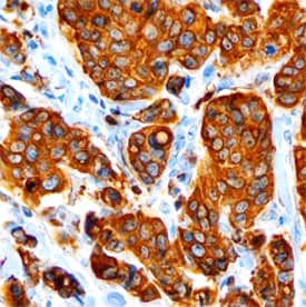 AG-3 antibody in Human Breast by Immunohistochemistry (IHC-P).