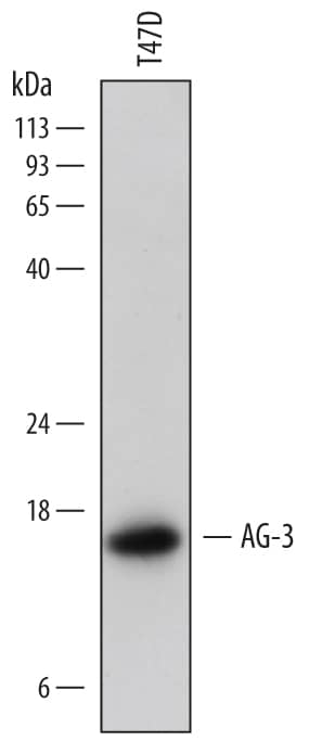 Detection of Human AG-3 antibody by Western Blot.