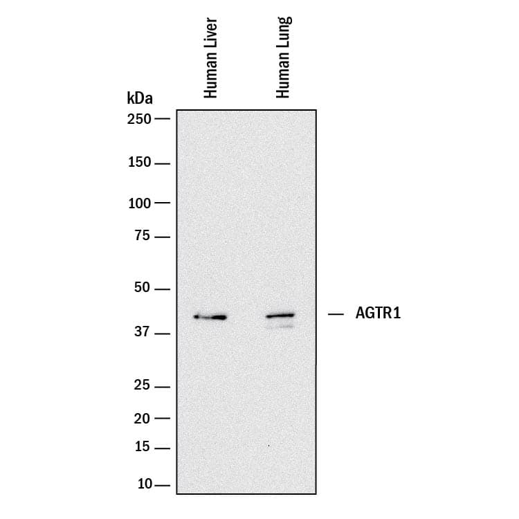 Detection of Human AGTR-1 antibody by Western Blot.