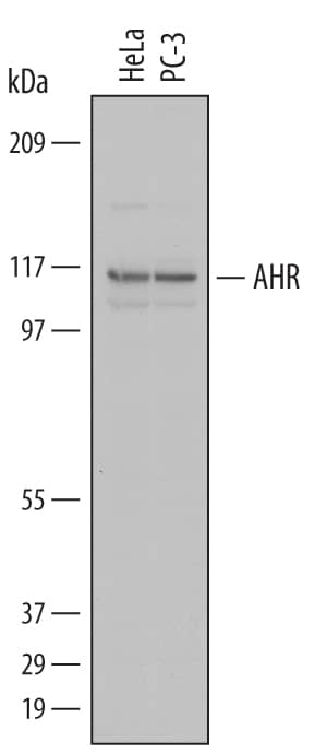 Detection of Human AHR antibody by Western Blot.