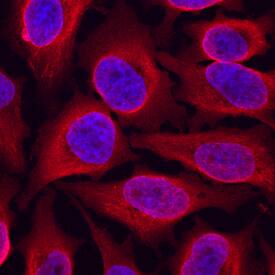 AHR antibody in HeLa Human Cell Line by Immunocytochemistry (ICC).