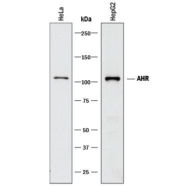 Detection of Human AHR antibody by Western Blot.