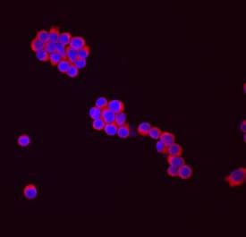 AICDA antibody in Ramos Human Cell Line by Immunocytochemistry (ICC).