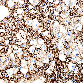 ALCAM/CD166 antibody in Mouse Liver.