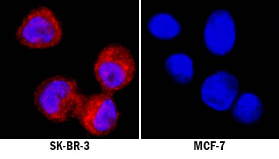 ALDH2 antibody in SK-BR-3 Human Cell Line by Immunocytochemistry (ICC).