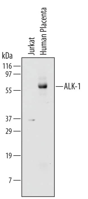 Detection of Human ALK-1 antibody by Western Blot.