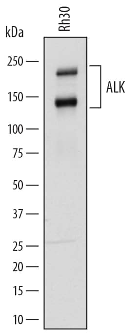 Detection of Human ALK/CD246 antibody by Western Blot.