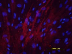 Alkaline Phosphatase/ALPL antibody in Human Osteoblasts by Immunocytochemistry (ICC).