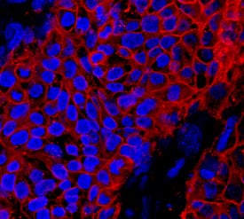 Alkaline Phosphatase/ALPL antibody in BG01V Human Embryonic Stem Cells by Immunocytochemistry (ICC).